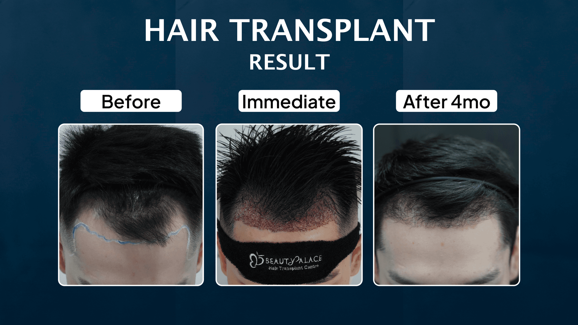 Hasil treatment ini juga nama